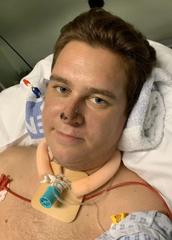 Zmiany martwicze obejmowały m.in. nos czy palce