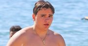 Prince Jackson też cierpi na bielactwo?!