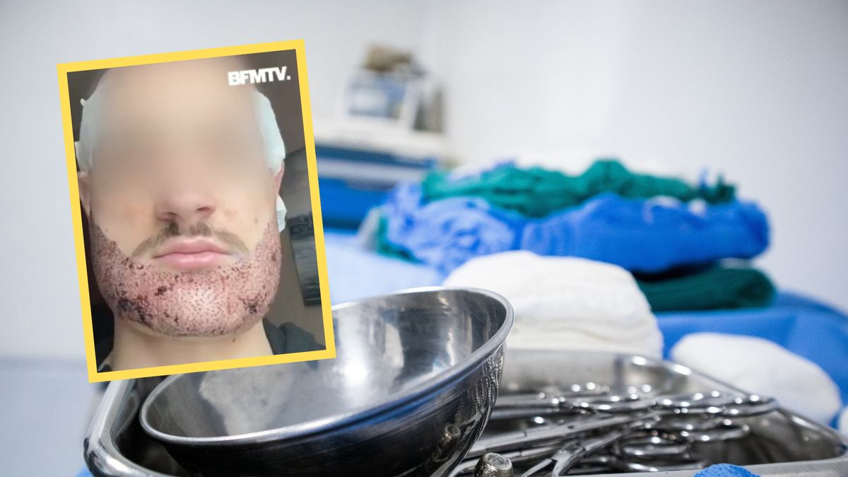 24-letni student z Francji pojechał do Turcji zrobić przeszczep brody. Potem zaczął się dramat 