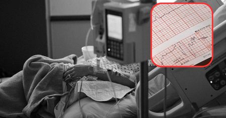 Przez pięć dni chodziła z zawałem serca. Lekarka przepisała jej antybiotyk