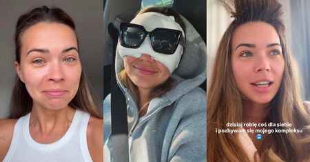 Sandra Kubicka relacjonuje OPERACJĘ POWIEK: "Branża mnie do tego zmusiła. Co chwilę chodzę i ryczę"