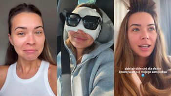 Sandra Kubicka relacjonuje OPERACJĘ POWIEK: "Branża mnie do tego zmusiła. Co chwilę chodzę i ryczę"