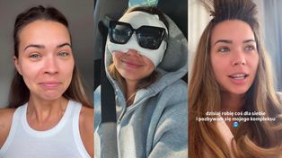 Sandra Kubicka relacjonuje OPERACJĘ POWIEK: "Branża mnie do tego zmusiła. Co chwilę chodzę i ryczę"