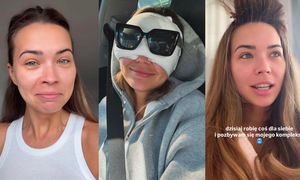 Sandra Kubicka relacjonuje OPERACJĘ POWIEK: "Branża mnie do tego zmusiła. Co chwilę chodzę i ryczę"