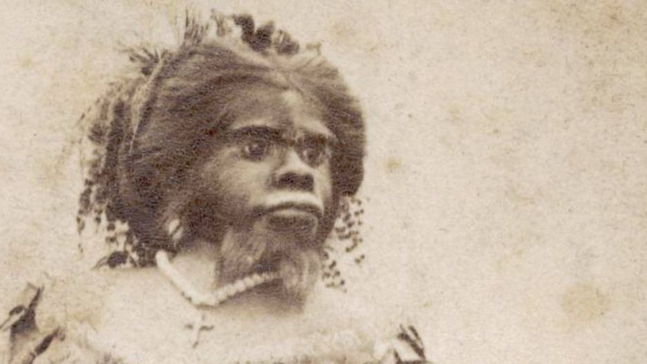 Mówili o niej "dziewczynka małpka". Przeżyła piekło