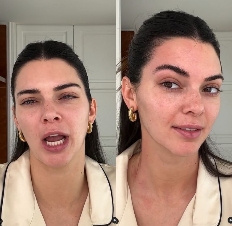 Naturalna Kendall Jenner zszokowała internautów