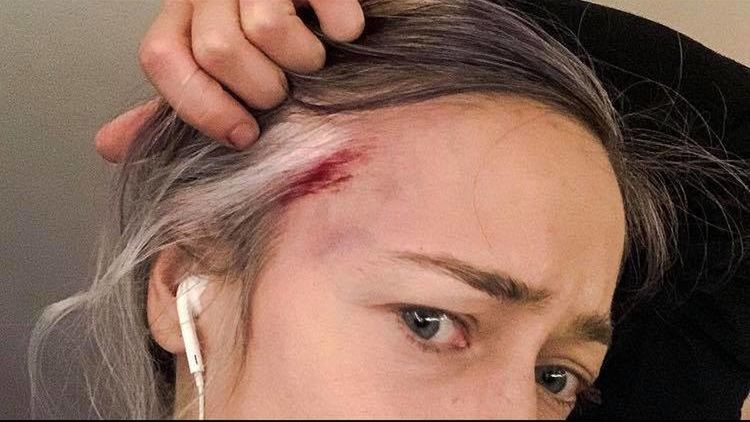 Matylda Damięcka uderzona przez policjanta