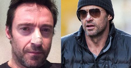 Jackman MIAŁ KOLEJNEGO CZERNIAKA! "Proszę, UŻYWAJCIE FILTRA!"