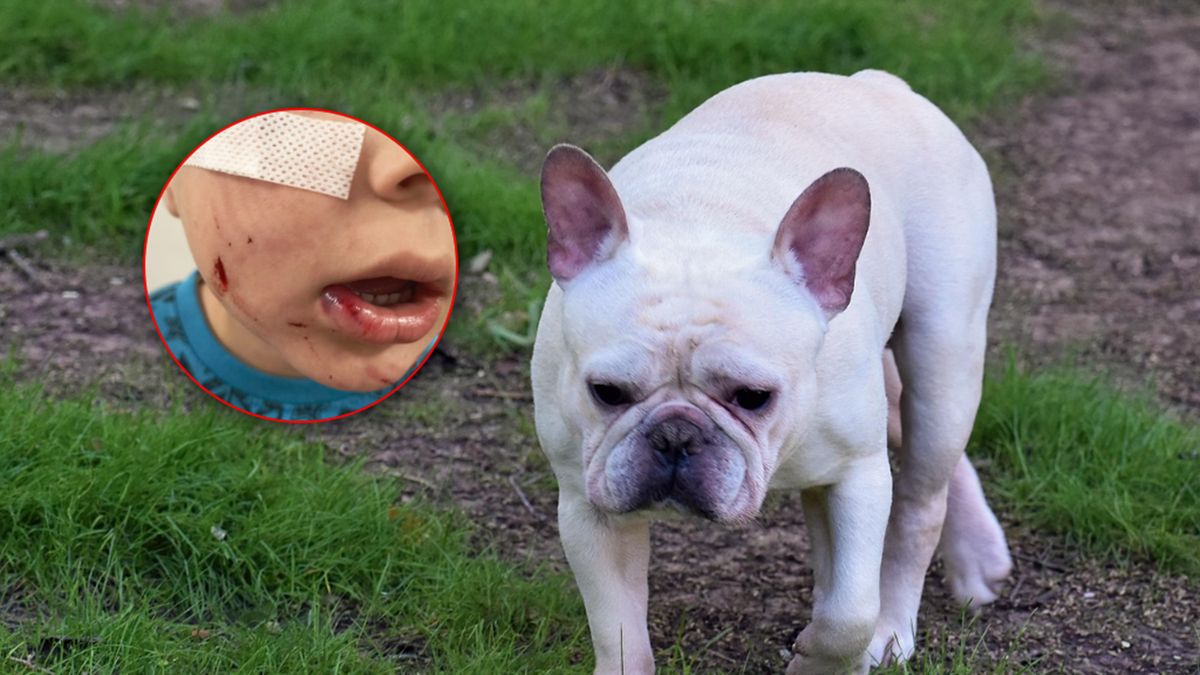 Frania zaatakował prawdopodobnie buldog francuski.