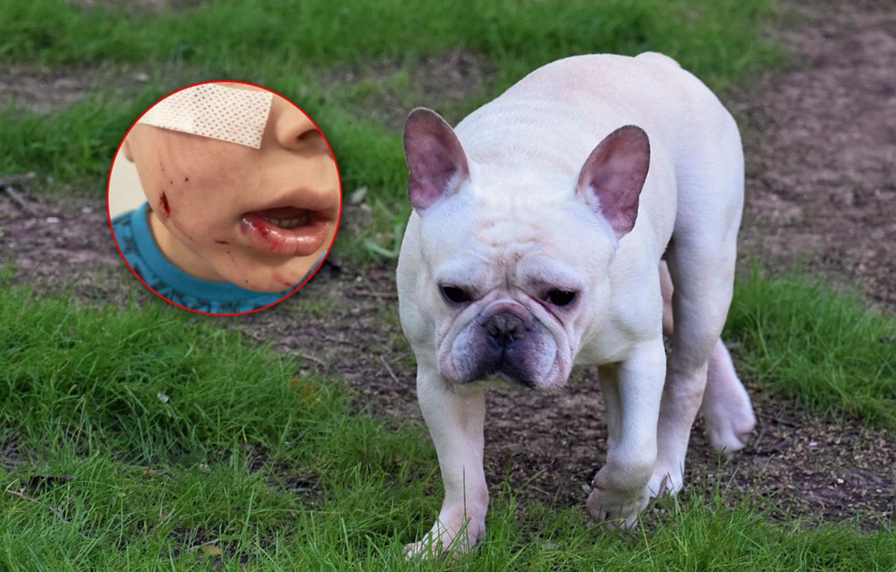 Frania zaatakował prawdopodobnie buldog francuski.