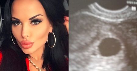 Z OSTATNIEJ CHWILI: Esmeralda Godlewska jest w ciąży?!