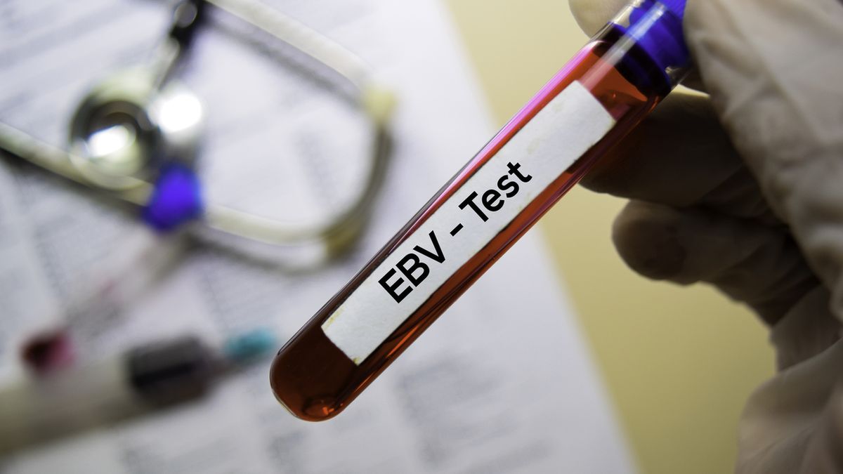 Wirus EBV (wirus Epsteina-Barr) występuje dość powszechnie w naszej populacji. Szacuje się, że zarażonych może być nawet 80% osób powyżej 40. roku życia lub starszych.