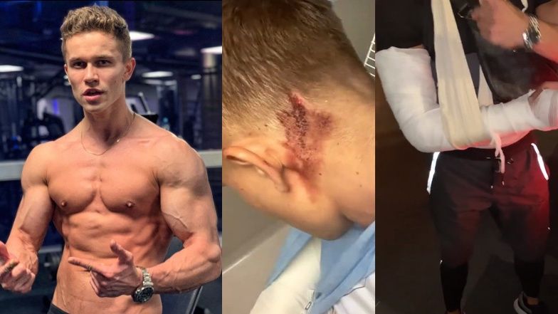 Łukasz z "Hotelu Paradise" został pobity