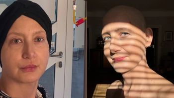 Walcząca z nowotworem Monika Pikuła opublikowała zdjęcie ze szpitala: "Karmienie KOSMITÓW" (FOTO)
