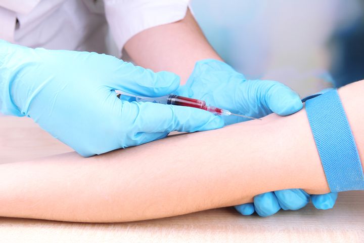 Morfologia to badanie parametrów krwi pobranej z żyły w zgięciu ręki