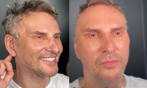 Gojdź z nową twarzą za 150 tys. złotych rozprawia o dojrzałości: "To nie koniec młodości, lecz początek nowej jakości"