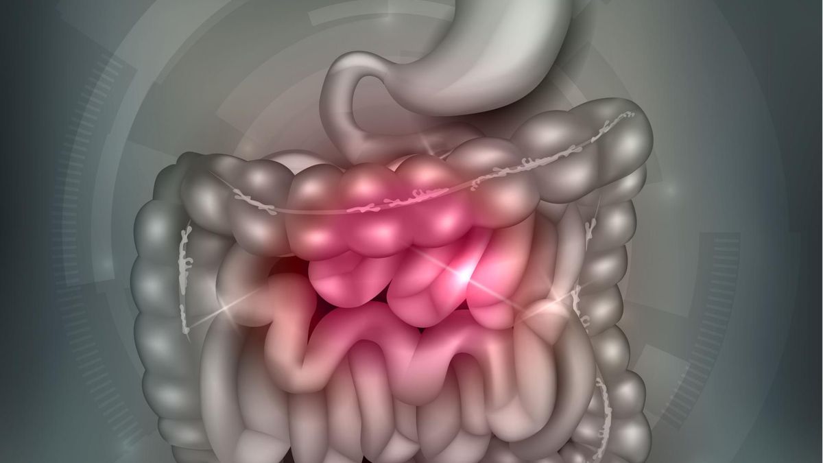Rak jelita grubego to jeden z najczęstszych nowotworów