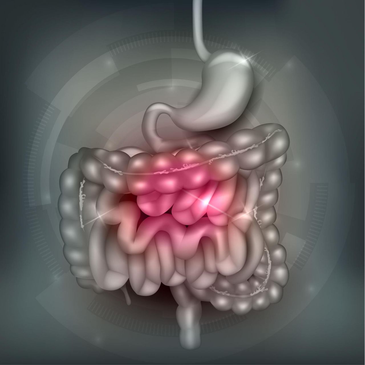 Rak jelita grubego coraz częstszy u Polaków. Rozmowa z dr. Krzysztofem Abychtem