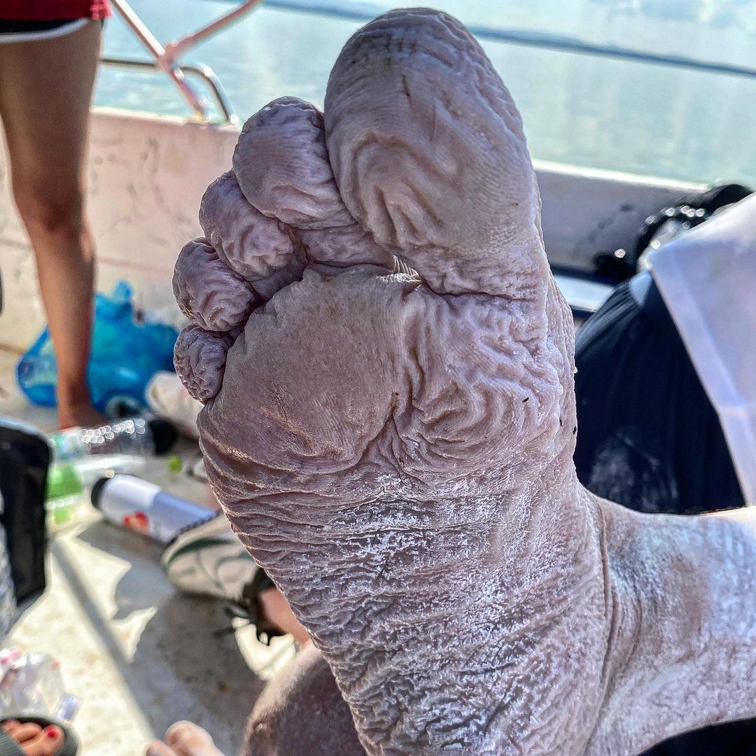 Pływak pokazał, jak wygląda jego skóra po zakończeniu nietypowego wyzwania