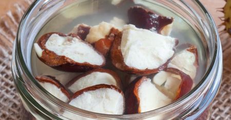 Flebolog poleca. 3 naturalne sposoby na żylaki