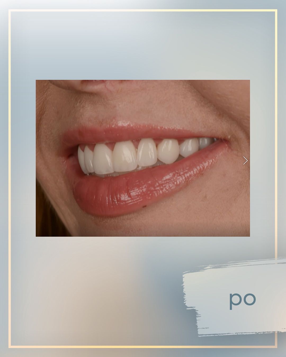 Emilia Plenski "Bez kompleksów"