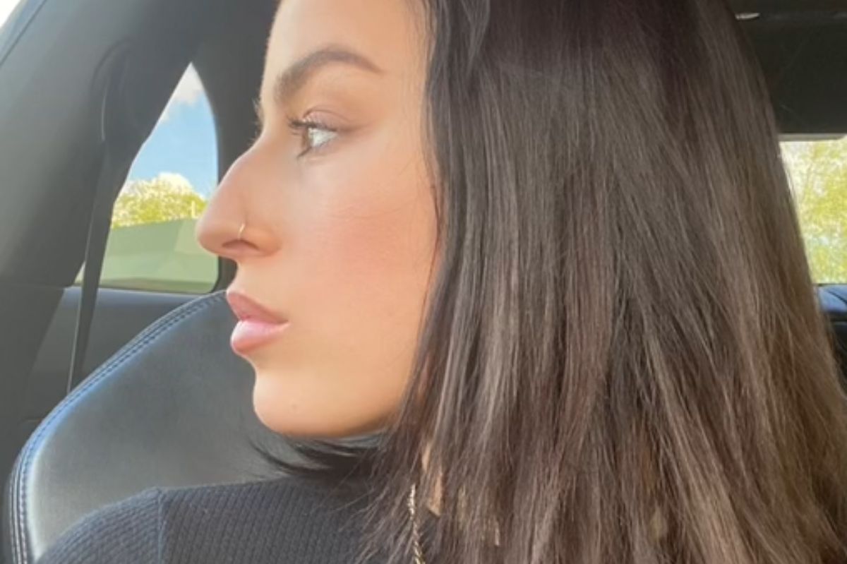 Frugal TikTok user Beckie Adams splurges savings on nose job, provokes divided opinions online