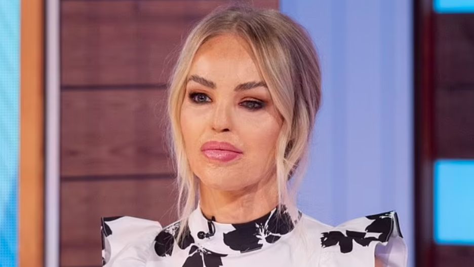 Katie Piper jest m.in. prezenterką w brytyjskiej telewizji