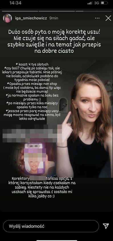 Iga Śmiechowicz zafundowała sobie korektę uszu