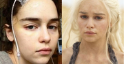 Emilia Clarke pokazuje zdjęcie po operacji i wspomina chorobę: "Część mojego mózgu faktycznie umarła"