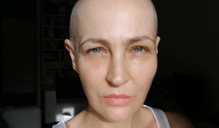 Anna Puślecka walczyła o refundację leku na raka. Teraz zmaga się z innym problemem