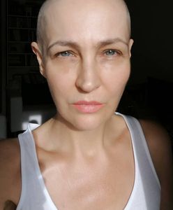 Anna Puślecka walczyła o refundację leku na raka. Teraz zmaga się z innym problemem