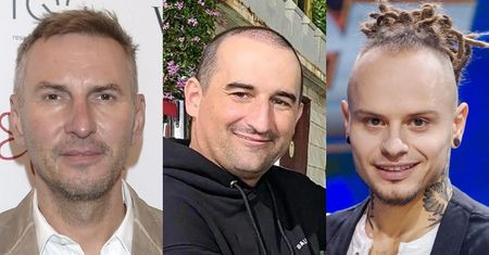 Nie tylko Misiek Koterski i Radosław Majdan. Te gwiazdy też zdecydowały się na PRZESZCZEP WŁOSÓW! (ZDJĘCIA)