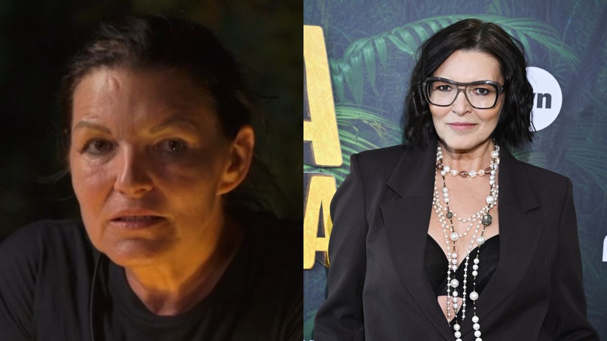 Ilona Felicjańska przeszła operację plastyczną