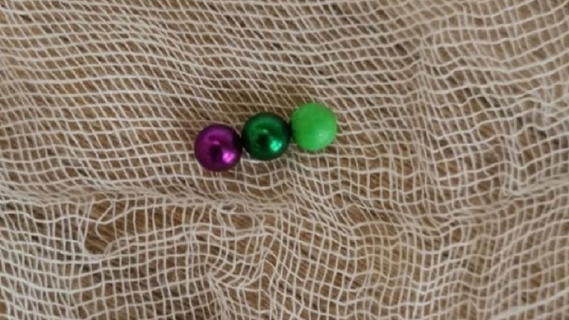 Lekarze ostrzegają przed kulkami magnetycznymi