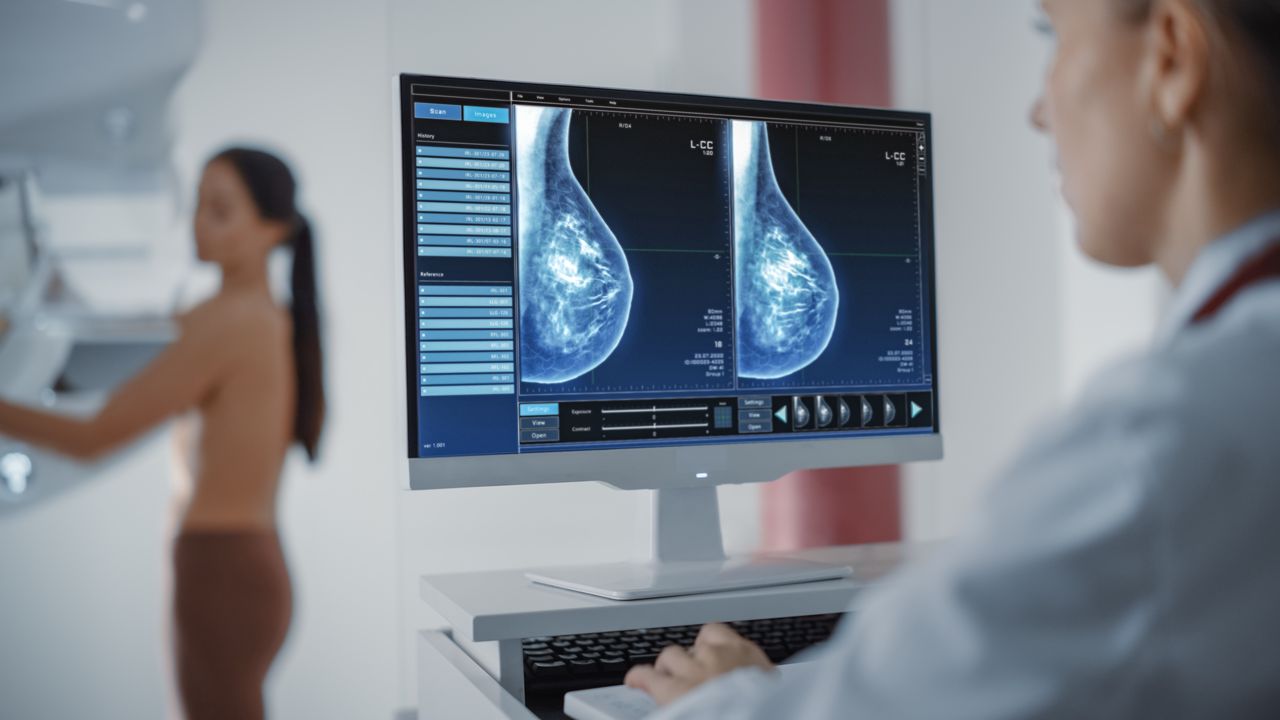 Bezpłatne badania mammograficzne. Mobilne laboratorium w Małopolsce