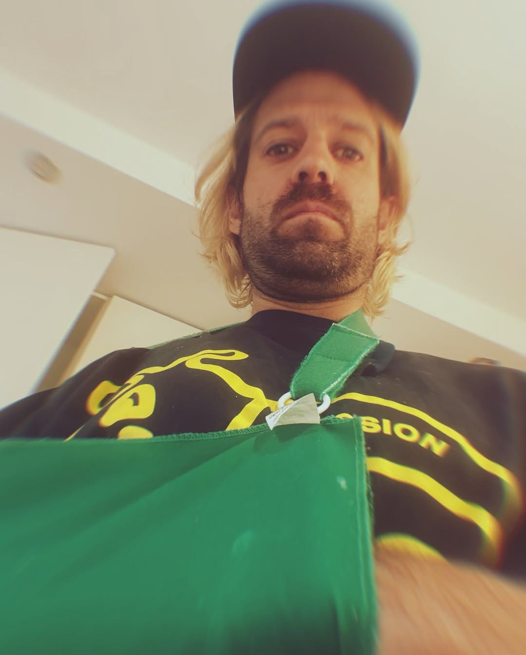 Michał Kempa musiał nosić temblak