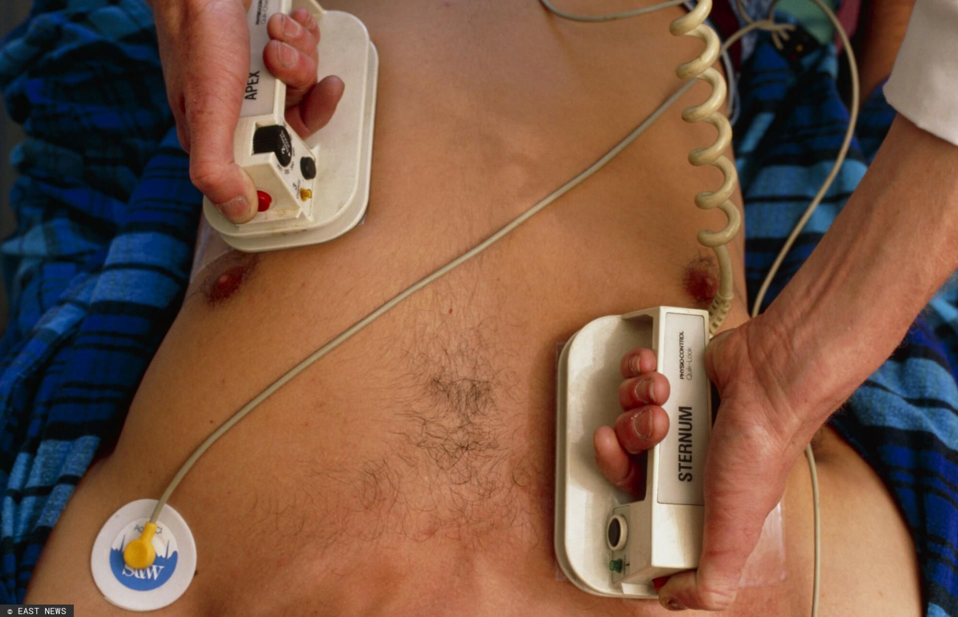 Jakie są objawy ZMS?