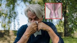 Objaw pojawiał się tylko, gdy stał. Wszystkiemu winny wirus