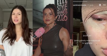 Malwina Wędzikowska komentuje lifting skroniowy znanej influencerki. "W wieku 27-lat NIE MA PRAWA nic ci opaść" (WIDEO)