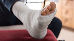 Złamanie trójkostkowe - przyczyny, leczenie i rehabilitacja