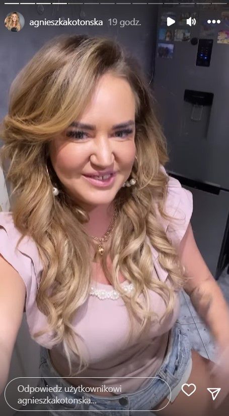 Agnieszka Kotońska pokazała twarz po zabiegu