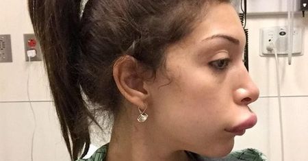 Farrah Abraham: amerykańska celebrytka ofiarą operacji plastycznej