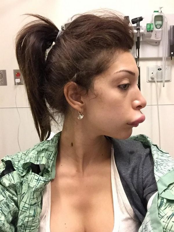 Farrah Abraham: amerykańska celebrytka ofiarą operacji plastycznej