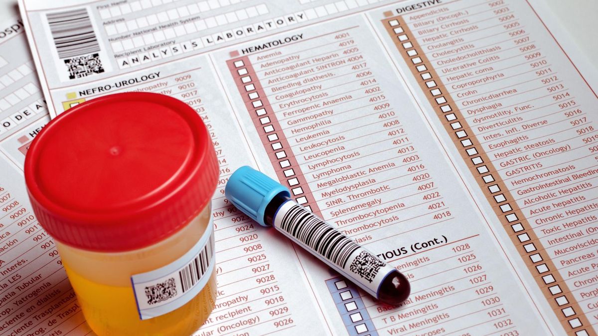 Krew w moczu w każdym przypadku jest to niepokojący objaw