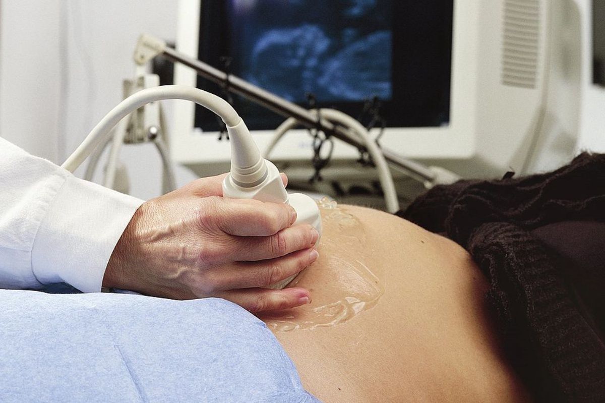 Odesłali ciężarną do domu. Tego samego dnia urodziła martwe dziecko