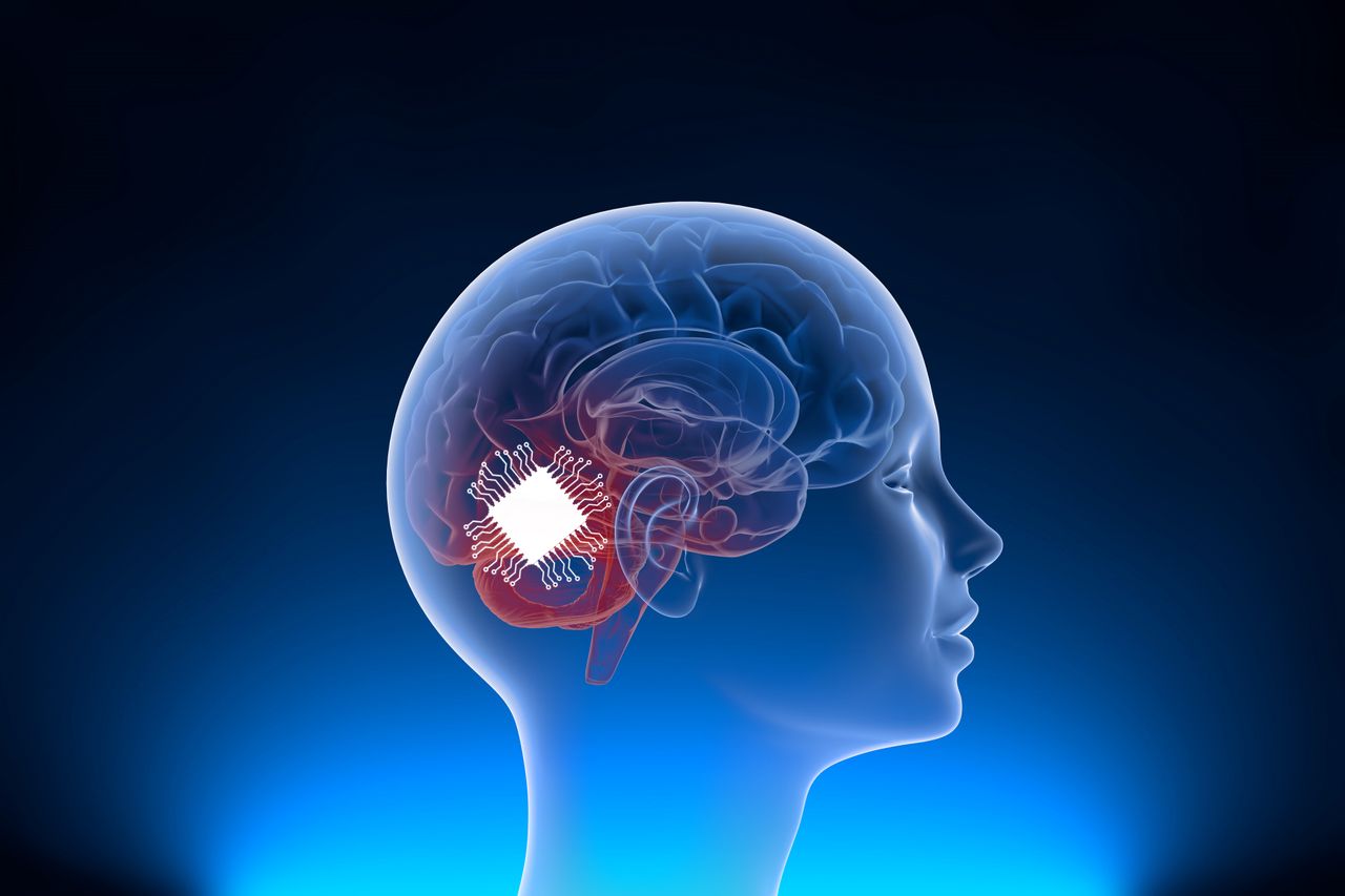 The Muska company has implanted the first brain chip in a human.