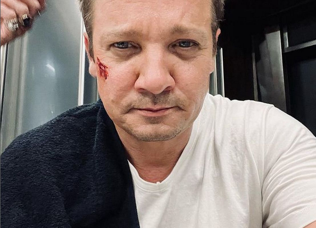 Jeremy Renner przeszedł operację. Rodzina gwiazdora zabrała głos