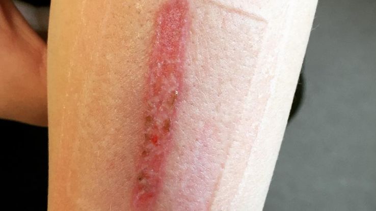 Młodzi ludzie chwalą się efektami wyzwania w mediach społecznościowych