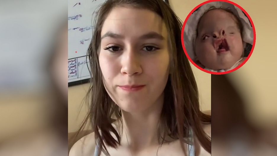 Ciężka wada wrodzona chłopca wywołała lawinę okropnych komentarzy