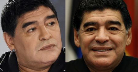 Maradona po OPERACJI PLASTYCZNEJ TWARZY! Poznajecie?